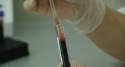 propecia remove back hair propecia remove back hair
