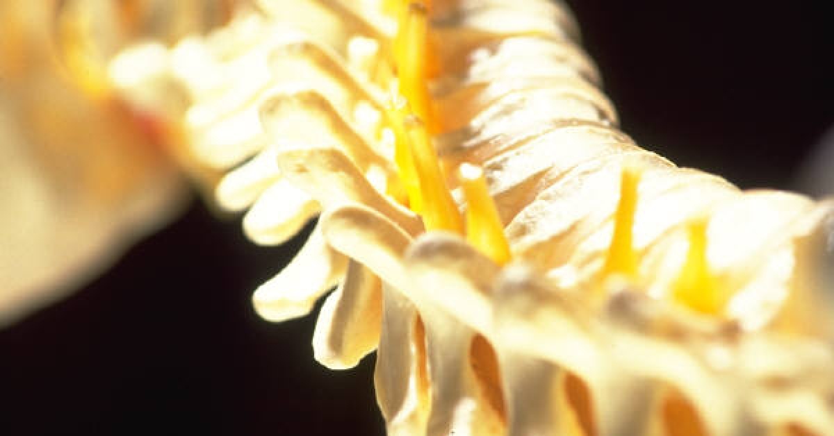 Medtronic Hires Yale to Review Spine Product RxWiki